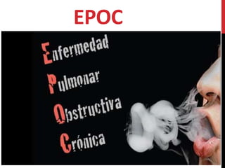 EPOC 
 