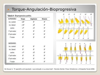  Torque-Angulación-Bioprogresiva
De Sousa V, "O aparelho pré-ajustado: sua evolução e su prescrioes“. Revista Dental. Press Ortodoncia y Ortopedia Facial.2006
 