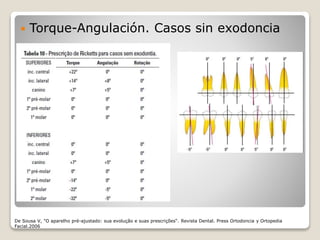  Torque-Angulación. Casos sin exodoncia
De Sousa V, "O aparelho pré-ajustado: sua evolução e suas prescrições“. Revista Dental. Press Ortodoncia y Ortopedia
Facial.2006
 