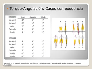 Torque-Angulación. Casos con exodoncia
De Sousa V, "O aparelho pré-ajustado: sua evolução e suas prescrições“. Revista Dental. Press Ortodoncia y Ortopedia
Facial.2006
 