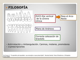  FILOSOFÍA
EVCC-Eje vertical
de la corona
clínica
Plano de Andrews
Pasa el Arco
Recto
Correcta colocación de
brackets
- Antirrotación y Antiangulación. Caninos, molares, premolares
- 11prescripciones
De Sousa V, "O aparelho pré-ajustado: sua evolução e suas prescrições“. Revista Dental. Press Ortodoncia y Ortopedia
Facial.2006
 