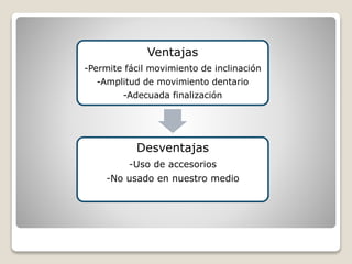 Ventajas
-Permite fácil movimiento de inclinación
-Amplitud de movimiento dentario
-Adecuada finalización
Desventajas
-Uso de accesorios
-No usado en nuestro medio
 