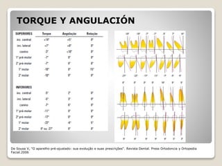 TORQUE Y ANGULACIÓN
De Sousa V, "O aparelho pré-ajustado: sua evolução e suas prescrições“. Revista Dental. Press Ortodoncia y Ortopedia
Facial.2006
 