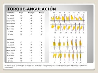 TORQUE-ANGULACIÓN
De Sousa V, "O aparelho pré-ajustado: sua evolução e suas prescrições“. Revista Dental. Press Ortodoncia y Ortopedia
Facial.2006
 
