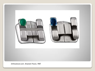 Orthoclever.com. Bracket Praxis. MBT
 