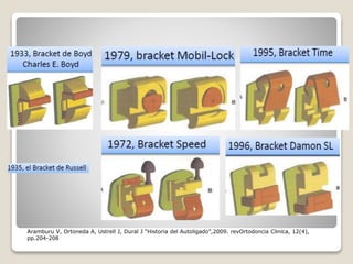 Aramburu V, Ortoneda A, Ustrell J, Dural J “Historia del Autoligado”,2009. revOrtodoncia Clinica, 12(4),
pp.204-208
 