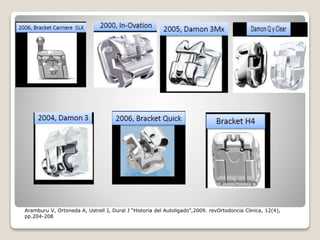 Aramburu V, Ortoneda A, Ustrell J, Dural J “Historia del Autoligado”,2009. revOrtodoncia Clinica, 12(4),
pp.204-208
 