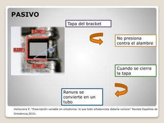 Tapa del bracket
No presiona
contra el alambre
Cuando se cierra
la tapa
Ranura se
convierte en un
tubo
PASIVO
Ventureira P. “Prescripción variable en ortodoncia: lo que todo ortodoncista debería conocer” Revista Española de
Ortodoncia,2010.
 