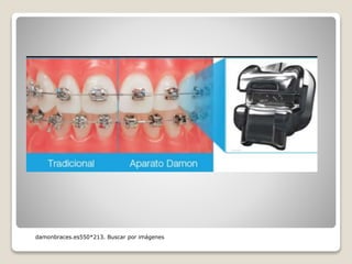 damonbraces.es550*213. Buscar por imágenes
 
