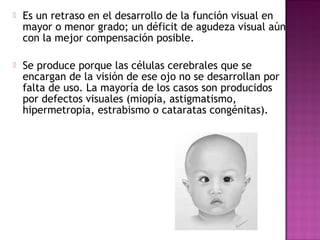  Es un retraso en el desarrollo de la función visual en
mayor o menor grado; un déficit de agudeza visual aún
con la mejor compensación posible.
 Se produce porque las células cerebrales que se
encargan de la visión de ese ojo no se desarrollan por
falta de uso. La mayoría de los casos son producidos
por defectos visuales (miopía, astigmatismo,
hipermetropía, estrabismo o cataratas congénitas).
 