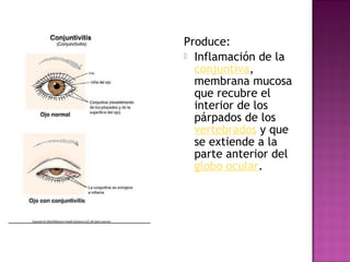 Produce:
 Inflamación de la
conjuntiva,
membrana mucosa
que recubre el
interior de los
párpados de los
vertebrados y que
se extiende a la
parte anterior del
globo ocular.
 