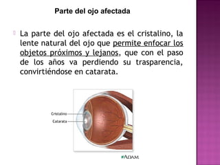  La parte del ojo afectada es el cristalino, la
lente natural del ojo que permite enfocar los
objetos próximos y lejanos, que con el paso
de los años va perdiendo su trasparencia,
convirtiéndose en catarata.
Parte del ojo afectada
 