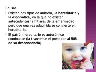 Causas
 Existen dos tipos de aniridia, la hereditaria y
la esporádica, en la que no existen
antecedentes familiares de la enfermedad,
pero que una vez adquirida se convierte en
hereditaria.
 El patrón hereditario es autosómico
dominante (la transmite el portador al 50%
de su descendencia).
 