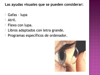 Las ayudas visuales que se pueden considerar:
 Gafas – lupa
 Atril.
 Flexo con lupa.
 Libros adaptados con letra grande.
 Programas específicos de ordenador.
 