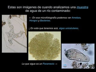 Estas son imágenes de cuando analizamos una  muestra  de agua de un río contaminado: ←  En esa microfotografía podemos ver  Amebas ,  Hongos  y  Bacterias . ↓  En esta que tenemos acá,  algas unicelulares . La que sigue es un  Paramecio  -> 