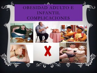 OBESIDAD ADULTO E
INFANTIL
COMPLICACIONES
 
