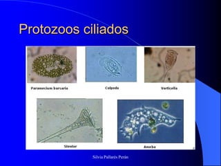 Protozoos ciliados




            Silvia Pallarés Perán
 