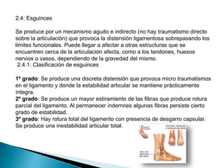 2.4: Esguinces
Se produce por un mecanismo agudo e indirecto (no hay traumatismo directo
sobre la articulación) que provoca la distensión ligamentosa sobrepasando los
limites funcionales. Puede llegar a afectar a otras estructuras que se
encuentren cerca de la articulación afecta, como a los tendones, huesos
nervios o vasos, dependiendo de la gravedad del mismo.
2.4.1: Clasificación de esguinces
1º grado: Se produce una discreta distensión que provoca micro traumatismos
en el ligamento y donde la estabilidad articular se mantiene prácticamente
íntegra.
2º grado: Se produce un mayor estiramiento de las fibras que produce rotura
parcial del ligamento. Al permanecer indemnes algunas fibras persiste cierto
grado de estabilidad.
3º grado: Hay rotura total del ligamento con presencia de desgarro capsular.
Se produce una inestabilidad articular total.

 