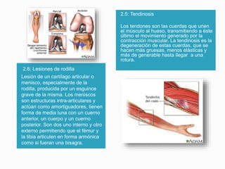 2.5: Tendinosis
Los tendones son las cuerdas que unen
el músculo al hueso, transmitiendo a éste
último el movimiento generado por la
contracción muscular. La tendinosis es la
degeneración de estas cuerdas, que se
hacen más gruesas, menos elásticas y
más de generable hasta llegar a una
rotura.

2.6: Lesiones de rodilla
Lesión de un cartílago articular o
menisco, especialmente de la
rodilla, producida por un esguince
grave de la misma. Los meniscos
son estructuras intra-articulares y
actúan como amortiguadores, tienen
forma de media luna con un cuerno
anterior, un cuerpo y un cuerno
posterior. Son dos uno interno y otro
externo permitiendo que el fémur y
la tibia articulen en forma armónica
como si fueran una bisagra.

 