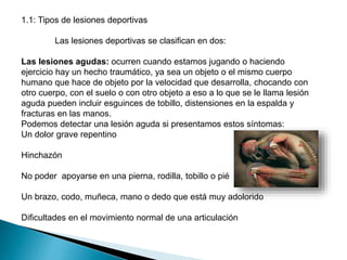 1.1: Tipos de lesiones deportivas
Las lesiones deportivas se clasifican en dos:
Las lesiones agudas: ocurren cuando estamos jugando o haciendo
ejercicio hay un hecho traumático, ya sea un objeto o el mismo cuerpo
humano que hace de objeto por la velocidad que desarrolla, chocando con
otro cuerpo, con el suelo o con otro objeto a eso a lo que se le llama lesión
aguda pueden incluir esguinces de tobillo, distensiones en la espalda y
fracturas en las manos.
Podemos detectar una lesión aguda si presentamos estos síntomas:
Un dolor grave repentino
Hinchazón

No poder apoyarse en una pierna, rodilla, tobillo o pié
Un brazo, codo, muñeca, mano o dedo que está muy adolorido
Dificultades en el movimiento normal de una articulación

 