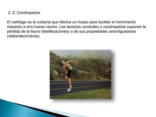 2. 2: Condropatías
El cartílago es la cubierta que fabrica un hueso para facilitar el movimiento
respecto a otro hueso vecino. Las lesiones condrales o condropatías suponen la
pérdida de la lisura (desflecaciones) o de sus propiedades amortiguadoras
(reblandecimiento).

 