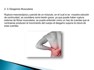 2. 3: Desgarres Musculares
Ruptura macroscópica y parcial de un músculo, en el cual si se muestra solución
de continuidad, se considera como lesión grave, ya que puede haber ruptura
extensa de fibras musculares, se puede entender como un haz de cuerdas que al
contraerse producen el movimiento del cuerpo el desgarro supone la rotura de
esas cuerdas.

 