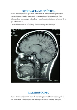 RESONACIA MAGNÉTICA
Es una técnica no invasiva que utiliza el fenómeno de la resonancia magnética para
obtener información sobre la estructura y composición del cuerpo a analizar. Esta
información es procesada por ordenadores y transformada en imágenes del interior de lo
que se ha analizado.
Observar alteraciones en los tejidos y detectar cáncer y otras patologías
LAPAROSCOPIA
Es una técnica que permite la visión de la cavidad pélvica-abdominal con la ayuda de
una lente óptica. A través de una fibra óptica, por un lado se transmite la luz para
 