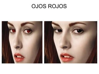 OJOS ROJOS




          
 