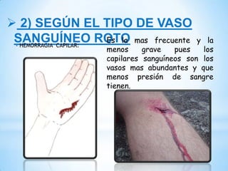  2) SEGÚN EL TIPO DE VASO
SANGUÍNEO ROTO- HEMORRAGIA CAPILAR:
Es la mas frecuente y la
menos grave pues los
capilares sanguíneos son los
vasos mas abundantes y que
menos presión de sangre
tienen.
 