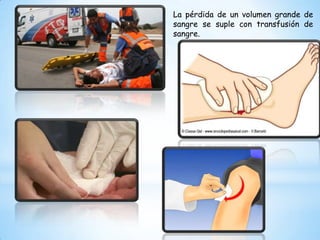 La pérdida de un volumen grande de
sangre se suple con transfusión de
sangre.
 