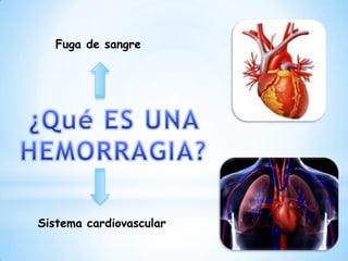 Fuga de sangre
Sistema cardiovascular
 