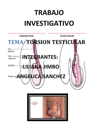 TRABAJO
INVESTIGATIVO
TEMA: TORSION TESTICULAR
INTEGRANTES:
-LILIANA JIMBO
-ANGELICA SANCHEZ
 