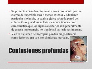 • Se presentan cuando el traumatismo es producido por un
  cuerpo de superficie más o menos extensa y adquieren
  particular violencia, la cual se ejerce sobre la pared del
  cráneo, tórax y abdomen. Estas lesiones tienen como
  característica que los signos al exterior son generalmente
  de escasa importancia, no siendo así las lesiones internas.
• Y en el dictamen de necropsia pueden diagnosticarse
  como lesiones que son por sí mismas mortales.



Contusiones profundas
 