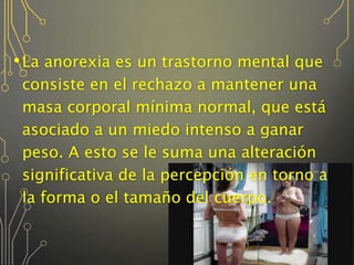 •La anorexia es un trastorno mental que
consiste en el rechazo a mantener una
masa corporal mínima normal, que está
asociado a un miedo intenso a ganar
peso. A esto se le suma una alteración
significativa de la percepción en torno a
la forma o el tamaño del cuerpo.
 