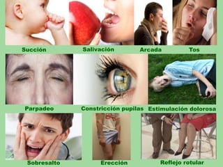 Succión Salivación Arcada Tos
Erección
Parpadeo Constricción pupilas
Sobresalto
Estimulación dolorosa
Reflejo rotular
 