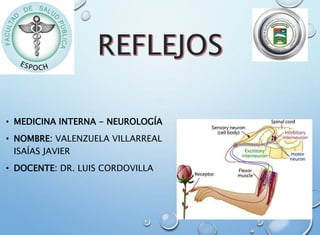 • MEDICINA INTERNA - NEUROLOGÍA
• NOMBRE: VALENZUELA VILLARREAL
ISAÍAS JAVIER
• DOCENTE: DR. LUIS CORDOVILLA
 