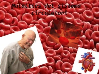 Malalties del sistema
circulatori

 