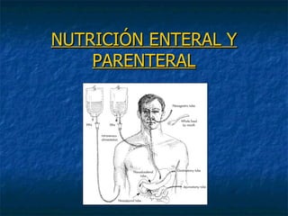 NUTRICIÓN ENTERAL Y
    PARENTERAL
 