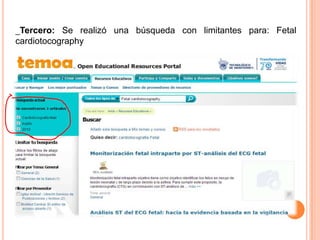 _Tercero: Se realizó una búsqueda con limitantes para: Fetal
cardiotocography
 