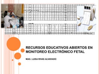 RECURSOS EDUCATIVOS ABIERTOS EN
MONITOREO ELECTRÓNICO FETAL
MAG. LUISA RIVAS ALVARADO
 