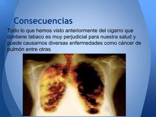 Consecuencias
Todo lo que hemos visto anteriormente del cigarro que
contiene tabaco es muy perjudicial para nuestra salud y
puede causarnos diversas enfermedades como cáncer de
pulmón entre otras.

 
