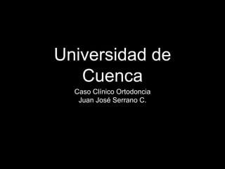 Universidad de
Cuenca
Caso Clínico Ortodoncia
Juan José Serrano C.
 