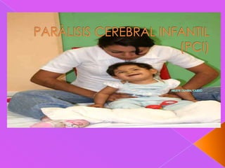 PARÀLISIS CEREBRAL INFANTIL(PCI) ARLETTE OLIVERA TOLEDO 