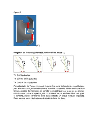 Como Se Expresa El Torque En Biomecanica DOCX como-se-expresa-el-torque-en-biomecanica-docx