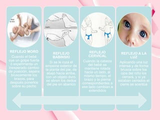 REFLEJO MORO 
Cuando el bebé 
oye un golpe fuerte 
o experimenta un 
inesperado cambio 
de posición, separa 
bruscamente los 
brazos, para 
después ponerlos 
sobre su pecho 
REFLEJO 
BABINSKI 
Si se le roza el 
empeine exterior de 
la planta del pie, de 
abajo hacia arriba, 
con un objeto duro, 
se abren los dedos 
del pie en abanico 
REFLEJO 
CERVICAL 
Cuando la cabeza 
del bebé se 
mantiene rotada 
hacia un lado, al 
mismo tiempo, el 
brazo y la pierna 
correspondientes a 
ese lado cambian a 
extendidos 
REFLEJO A LA 
LUZ 
Aplicando una luz 
intensa y de forma 
brusca sobre los 
ojos del niño los 
cerrará, y si ya 
estaban cerrados el 
cierre se acentúa 
 