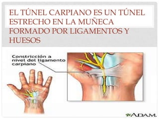 EL TÚNEL CARPIANO ES UN TÚNEL
ESTRECHO EN LA MUÑECA
FORMADO POR LIGAMENTOS Y
HUESOS
 