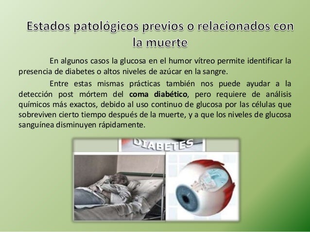 Humor Vitreo Humor Vitreo