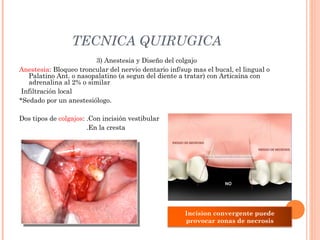TECNICA QUIRUGICA
3) Anestesia y Diseño del colgajo
Anestesia: Bloqueo troncular del nervio dentario inf/sup mas el bucal, el lingual o
Palatino Ant. o nasopalatino (a segun del diente a tratar) con Articaína con
adrenalina al 2% o similar
Infiltración local
*Sedado por un anestesiólogo.
Dos tipos de colgajos: .Con incisión vestibular
.En la cresta
Si la
Incision convergente puede
provocar zonas de necrosis
 