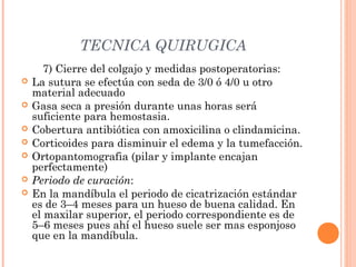 TECNICA QUIRUGICA
7) Cierre del colgajo y medidas postoperatorias:
 La sutura se efectúa con seda de 3/0 ó 4/0 u otro
material adecuado
 Gasa seca a presión durante unas horas será
suficiente para hemostasia.
 Cobertura antibiótica con amoxicilina o clindamicina.
 Corticoides para disminuir el edema y la tumefacción.
 Ortopantomografia (pilar y implante encajan
perfectamente)
 Periodo de curación:
 En la mandíbula el periodo de cicatrización estándar
es de 3–4 meses para un hueso de buena calidad. En
el maxilar superior, el periodo correspondiente es de
5–6 meses pues ahí el hueso suele ser mas esponjoso
que en la mandíbula.
 