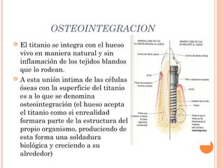 OSTEOINTEGRACION
 El titanio se integra con el hueso
vivo en maniera natural y sin
inflamación de los tejidos blandos
que lo rodean.
 A esta unión intima de las células
óseas con la superficie del titanio
es a lo que se denomina
osteointegración (el hueso acepta
el titanio como si enrealidad
formara parte de la estructura del
propio organismo, produciendo de
esta forma una soldadura
biológica y creciendo a su
alrededor)
 